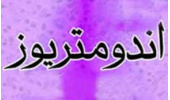 اندومتریوز قابل درمان است/ سهم بالای بانوان ساکن  شهرهای صنعتی از این بیماری