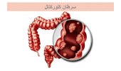 اجرای طرح «مطالعه تأثیر متامفتامین بر ژن‌های دخیل در سرطان کلورکتال» در فارس