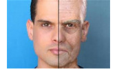 اثر حفاظتی عصاره غشا آمنیوتیک از سلول‌های فیبروبلاست پوست