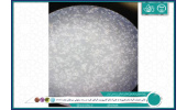 تاثیر عصاره گیاه بادرنجبویه به همراه نانو کامپوزیت گرافن نقره در رده سلولی سرطان معده (AGS)